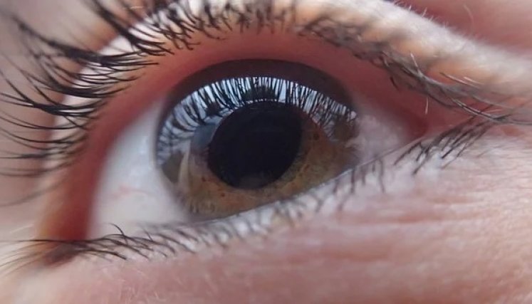 El glaucoma es una enfermedad silenciosa. / Foto: Cortesía