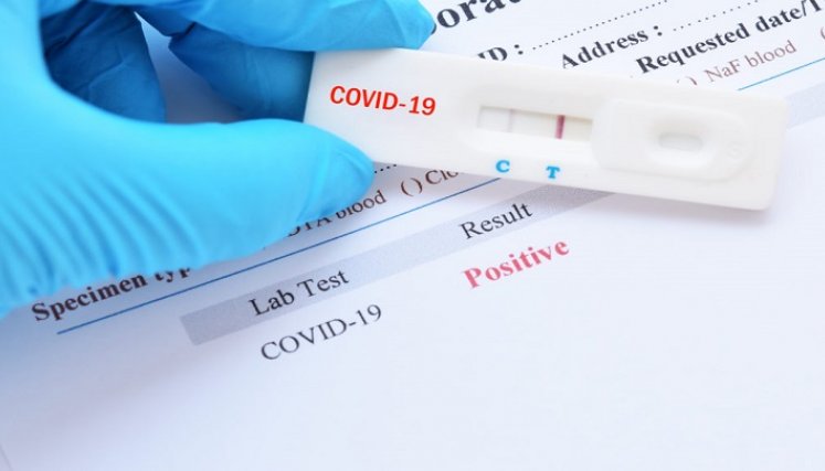 Casos activos de COVID-19 en el país ascienden a más de 100.000./FOTO: Tomada de internet