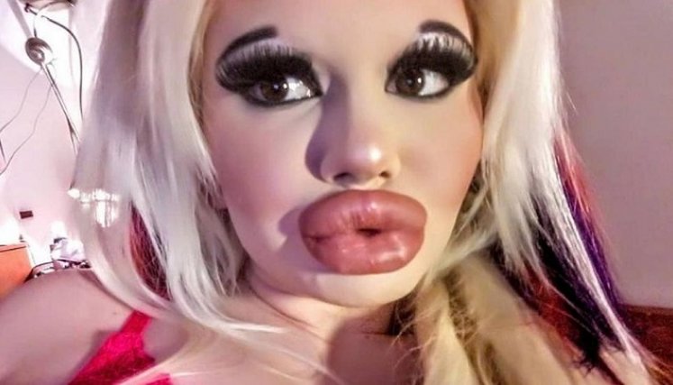 La influencer con los labios más grandes del mundo./FOTO: Tomada de internet