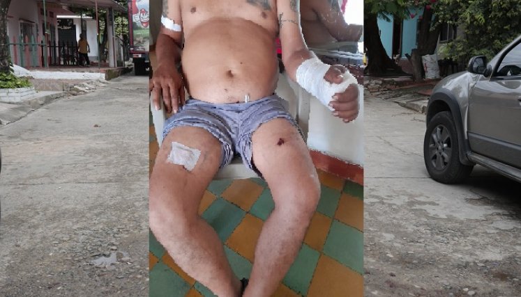 Jhon Jairo Orozco Vargas sobrevivió a un ataque a bala.