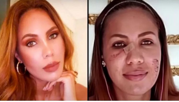 Así le quedó la cara a la modelo.