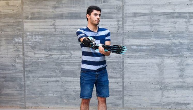 El estudiante universitario andorrano David Aguilar, 22 años, afectado por el síndrome de Poland, muestra su prótesis de brazo fabricada por él mismo con piezas de Lego. / Foto: AFP