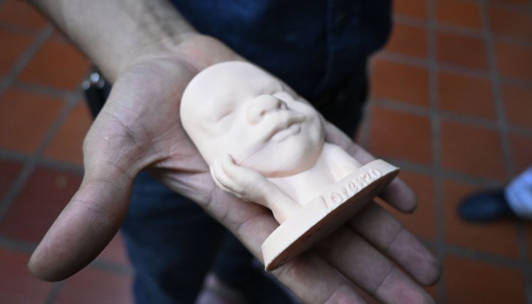 Lorenzo es el primer prototipo de ecografía 6D. Foto: Jorge Gutiérrez