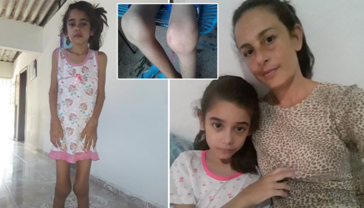 Alexamar Rodríguez Freitez, de 10 años, quien desde los 4 padece artritis idiopática juvenil. / Foto: Cortesúa