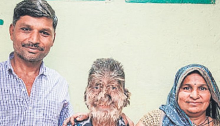 Al niño deben cortarle constantemente su pelo para no ahogarse. 