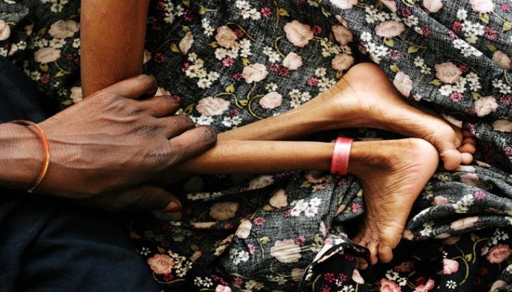 Medimás EPS ha identificado 76 niños con desnutrición en el  departamento, a quienes se les viene haciendo seguimiento  interdisciplinar, pedagogía en alimentación saludable y entrega de  suplementación. / Foto: Cortesía / La Opinión 