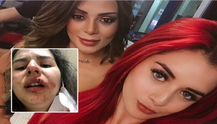 ¿Rafaella, hija de Marbelle agredió a una periodista?/Foto: internet