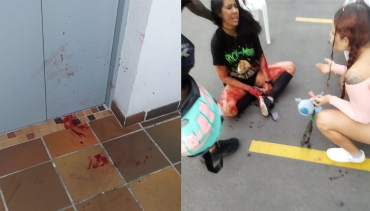 En Prados del Este se registró el ataque de un perro pitbull. 