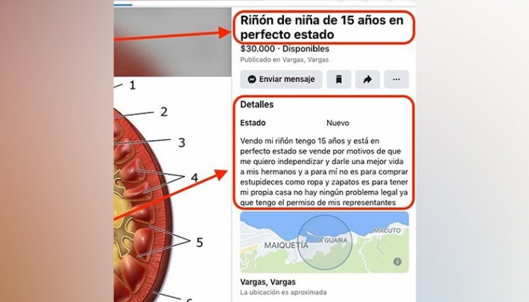 Venta de organos en Venezuela