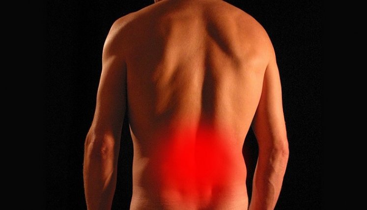 Dolor lumbar. / Foto: Cortesía