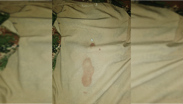 Militar herido.