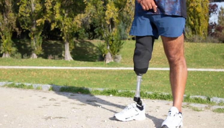 Investigadores realizan convocatoria para el desarrollo de aplicación digital que favorecería a pacientes amputados