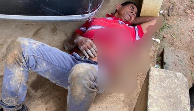 El misterio detrás del brutal ataque a un obrero en Cúcuta./Foto: cortesía