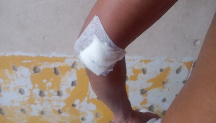 Un comerciante fue apuñalado en San Luis