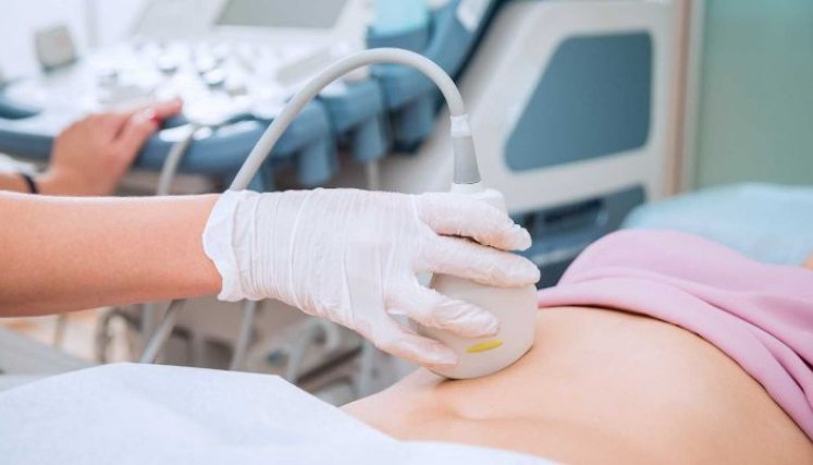 Las mujeres piden que se aliente la despenalización social y  se promueva una perspectiva de la IVE como un derecho humano fundamental./ Foto Cortesía / La Opinión