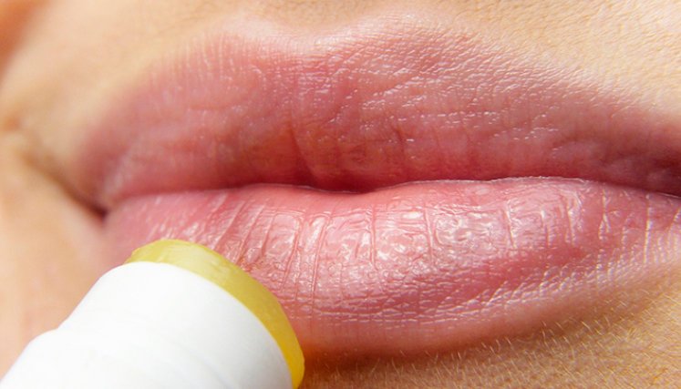 Labios.