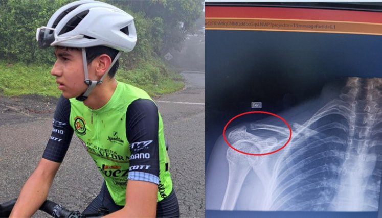 El toledano Kevin Fabiani Peñaloza Granados de 15, ciclista de las nuevas promociones del pedalismo nortesantandereano.
