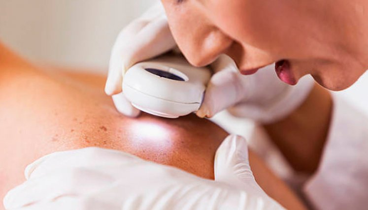 Dermatología 