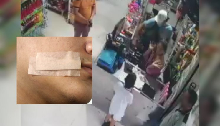 Un disparo en el rostro recibió un empleado 