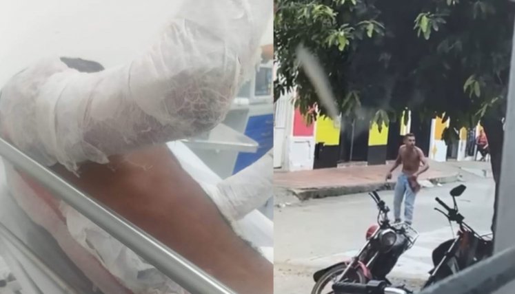 Quemado en Sardinata 