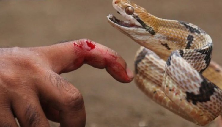 Mordedura de serpientes. / Foto: Cortesía / La Opinión 