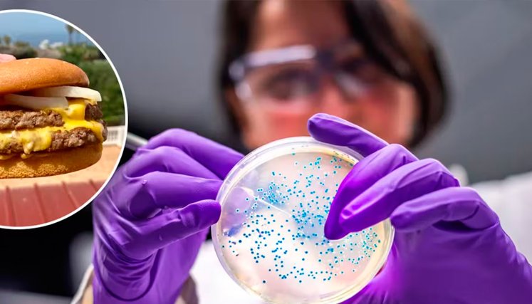  E. coli