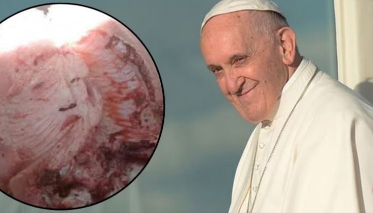 Papa Francisco. 