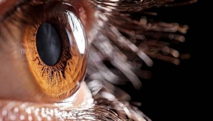 Vision