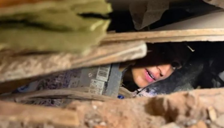 “Tuvieron que remover la piel”: Diana sobrevivió 30 horas bajo los escombros; ahora enfrenta las lesiones que dejó el terremoto