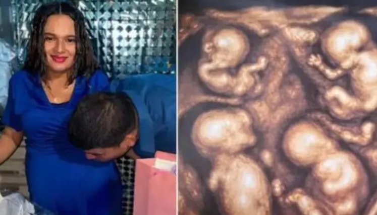 Nacieron los cuatrillizos en Medellín: madre y bebés permanecen bajo observación