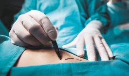 Más de 40 mujeres contrajeron una infección durante cirugía estética en Medellín. 