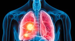 Pulmones. 