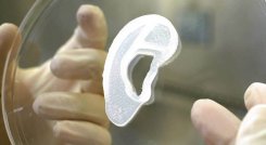 implantan oreja impresa 