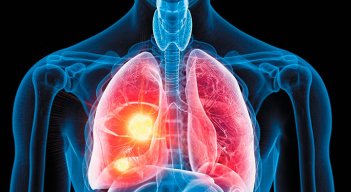 Pulmones. 
