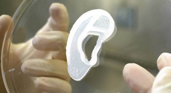implantan oreja impresa 