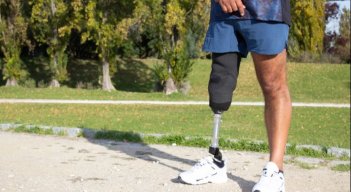 Investigadores realizan convocatoria para el desarrollo de aplicación digital que favorecería a pacientes amputados