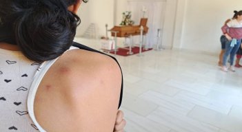 El fatal destino de Ana Elvira,  acorralada por las abejas